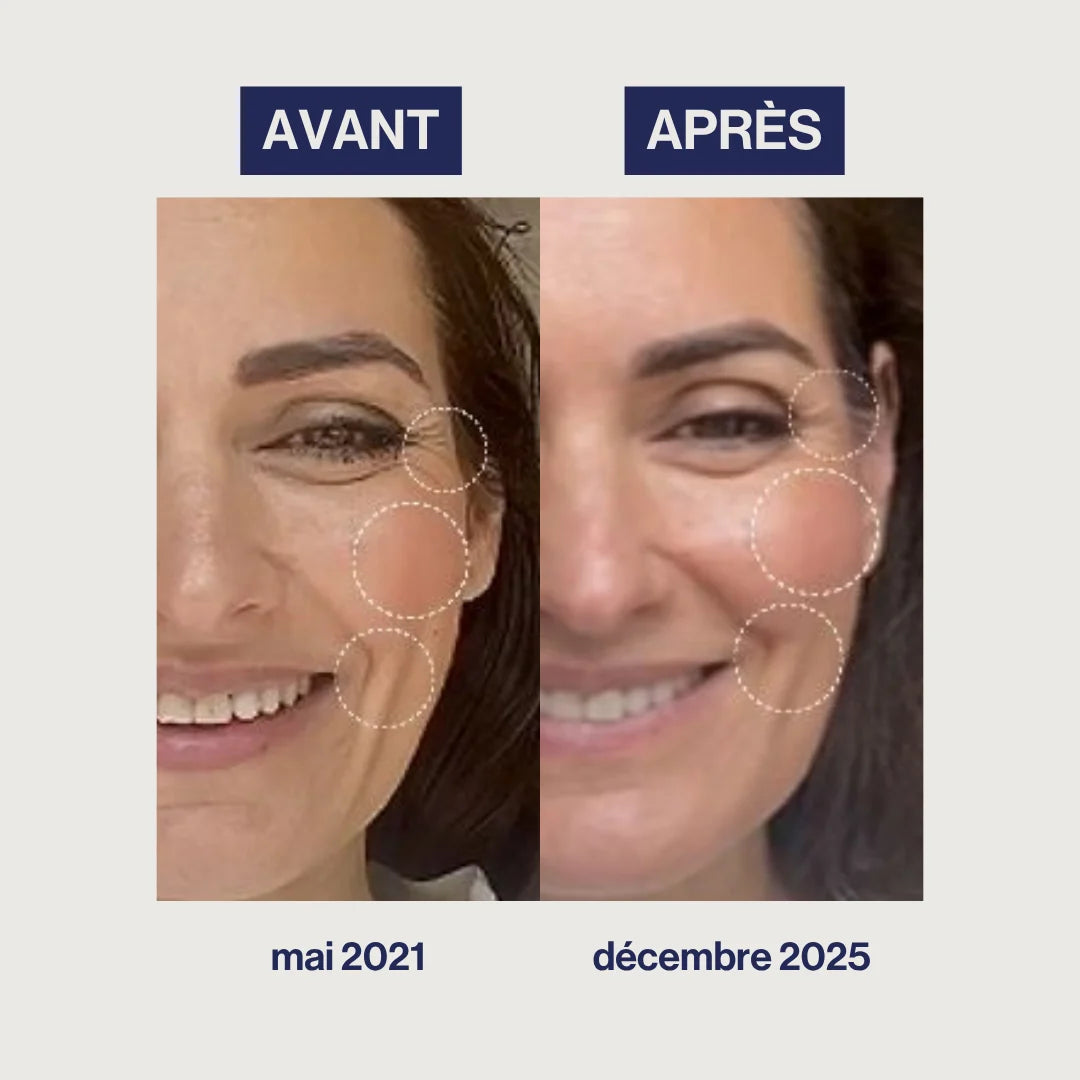 Age with Grace Augmented Collagen