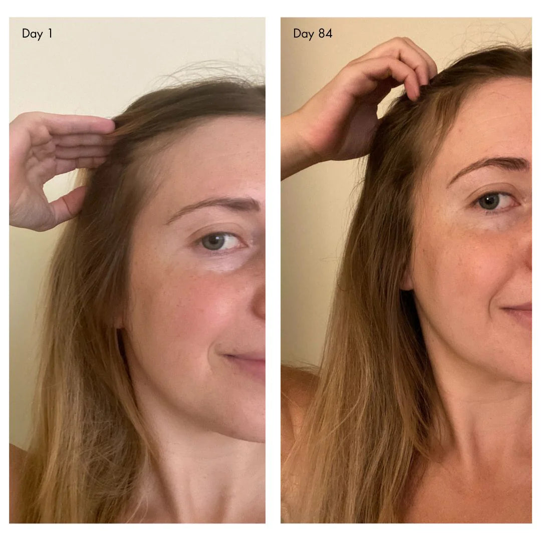 Holi (Growth) Leave-in Hair Growth Scalp Spray