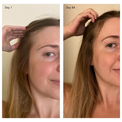 Holi (Growth) Leave-in Hair Growth Scalp Spray