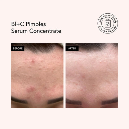 BL+C Pimples Black Cumin + Cajeput Serum Concentrate