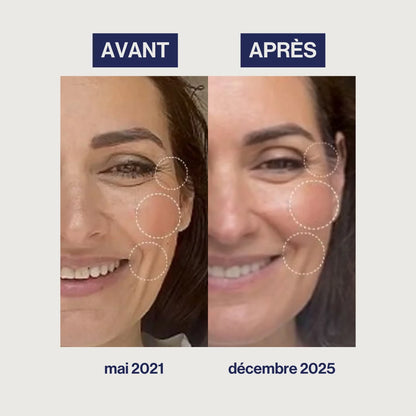 Age with Grace Augmented Collagen