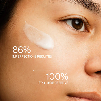 Balance Your Pores – Anti Blemish