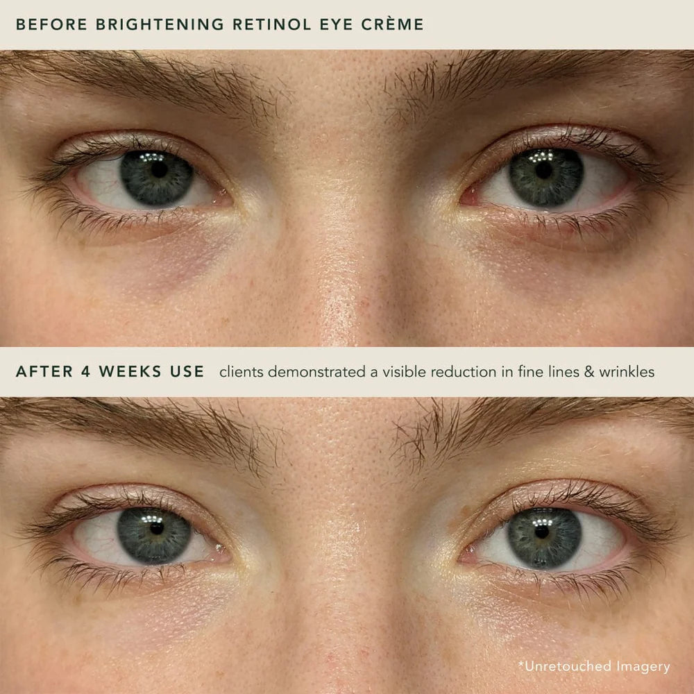 Brightening Retinol Eye Creme